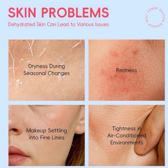 Quiyum Rosa Mosqueta 5pc Skincare Set Rosehip + Vitamin E Kit NEW/NIB - Picture 3 of 10